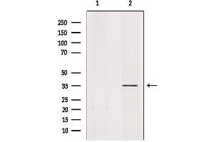 Western blot analysis of extracts from rat brain, using OR51A1P Antibody. (OR51A1P 抗体)