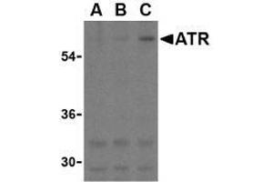 Western blot analysis of ATR in K562 cell lysates with this product atR antibody at (A) 0. (ANTXR1 抗体  (C-Term))