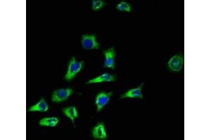 Immunofluorescence staining of A549 cells with ABIN7169583 at 1:100, counter-stained with DAPI. (CD164 抗体  (AA 24-162))