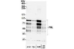 Western Blotting (WB) image for anti-Promyelocytic Leukemia (PML) (AA 375-425) antibody (ABIN7454722)