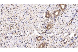Immunohistochemistry (IHC) image for anti-Basigin (Ok Blood Group) (BSG) (AA 59-321) antibody (ABIN7440611)