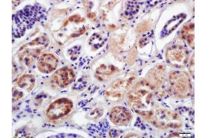 Immunohistochemistry (IHC) image for anti-Cytochrome P450, Family 2, Subfamily D, Polypeptide 6 (CYP2D6) (AA 101-210) antibody (ABIN682558)