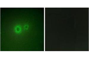 Immunofluorescence analysis of HUVEC cells, using LRAT antibody. (LRAT 抗体  (Internal Region))