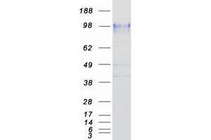 Western Blotting (WB) image for Selectin P (Granule Membrane Protein 140kDa, Antigen CD62) (SELP) protein (Myc-DYKDDDDK Tag) (ABIN2713752)