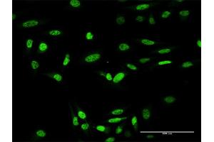 Immunofluorescence of purified MaxPab antibody to ING4 on HeLa cell. (ING4 抗体  (AA 1-249))