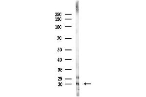 anti-Mitochondrial Ribosomal Protein S12 (MRPS12) (Internal Region) antibody