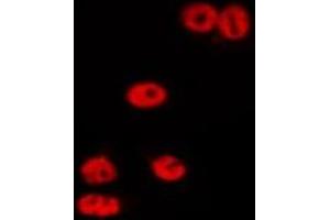ABIN6275685 staining HepG2 by IF/ICC. (ZSCAN22 抗体  (Internal Region))