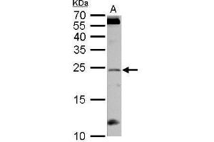 WB Image RGS4 antibody detects RGS4 protein by Western blot analysis. (RGS4 抗体)