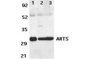 Western blot analysis of ARTS expression in human lung (lane 1),spleen (lane 2), and kidney (lane 3) tissue lysates with ARTS antibody at 2μg /ml. (Septin 4 抗体  (N-Term))