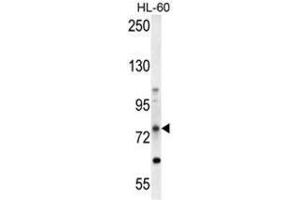 ABCD1 Antibody (Center) western blot analysis in HL-60 cell line lysates (35 µg/lane). (ABCD1 抗体  (Middle Region))