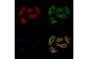 Phospho-SCD1 (Tyr55) Antibody staining Hela cells(heat shock treatment) by IF/ICC. (SCD 抗体  (pTyr55))