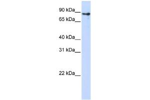 WB Suggested Anti-KLHL1 Antibody Titration:  0. (KLHL1 抗体  (Middle Region))