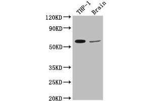 Western Blot Positive WB detected in: THP-1 whole cell lysate, Rat brain tissue All lanes: COL9A2 antibody at 1:2000 Secondary Goat polyclonal to rabbit IgG at 1/50000 dilution Predicted band size: 66 kDa Observed band size: 66 kDa (Collagen Type IX alpha 2 (COL9A2) (AA 594-611) 抗体)