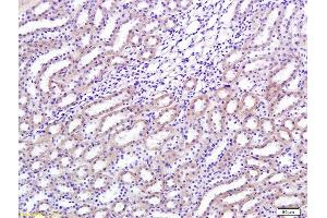 Formalin-fixed and paraffin embedded rat renal tissue labeled with Anti-TGF-beta-1 Polyclonal Antibody, Unconjugated (ABIN724685) 1:200 followed by conjugation to the secondary antibody and DAB staining (TGFB1 抗体  (AA 351-390))