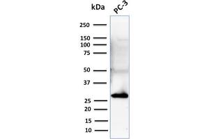 Western Blot Analysis of Human PC-3 cell lysate using Stratifin Mouse Monoclonal Antibody (CPTC-SFN-2). (14-3-3 sigma/SFN 抗体)