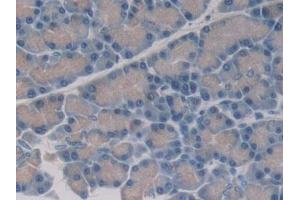 Detection of 15-LO-2 in Rat Pancreas Tissue using Polyclonal Antibody to 15-Lipoxygenase-2 (15-LO-2) (ALOX15B 抗体  (AA 349-633))