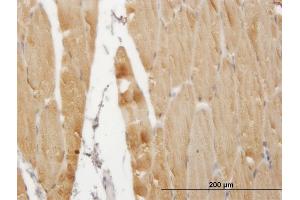 Immunostaining (ISt) image for anti-ATPase, Ca++ Transporting, Cardiac Muscle, Fast Twitch 1 (ATP2A1) (AA 522-612) antibody (ABIN2752056)