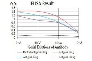 Black line: Control Antigen (100 ng),Purple line: Antigen (10 ng), Blue line: Antigen (50 ng), Red line:Antigen (100 ng) (RIPK4 抗体  (AA 675-784))