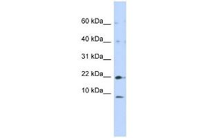 NDUFC2 antibody used at 1 ug/ml to detect target protein.
