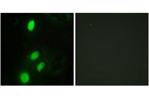 Immunofluorescence analysis of HeLa cells, using ETV6 Antibody. (ETV6 抗体  (AA 371-420))