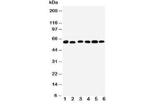 Western blot testing of Monoamine Oxidase B antibody and Lane 1:  mouse liver;  2: (m) lung;  3: rat kidney;  4: (r) brain;  5: (r) liver;  6: (r) lung tissue lysate (Monoamine Oxidase B 抗体  (N-Term))