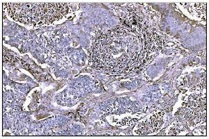 IHC analysis of NDEL1 using anti-NDEL1 antibody (ABIN7602511). (NDEL1 抗体  (AA 80-320))