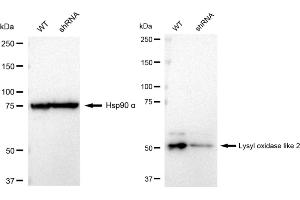 Western blotting analysis using Lysyl oxidase like 2 antibody (ABIN7799312). (Recombinant LOXL2 抗体)