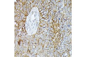 Immunohistochemistry (IHC) image for anti-Catenin (Cadherin-Associated Protein), beta 1, 88kDa (CTNNB1) antibody (ABIN7266137)