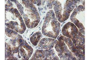 Image no. 4 for anti-Armadillo Repeat Containing 1 (ARMC1) antibody (ABIN1496727)
