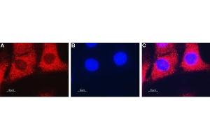 Immunocytochemistry (ICC) image for anti-Solute Carrier Family 29 (Nucleoside Transporters), Member 2 (SLC29A2) (AA 273-288) antibody (ABIN7043711)