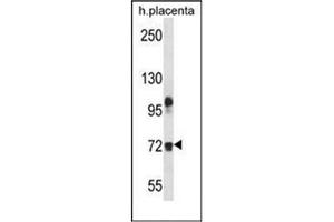 Western blot analysis of Fibulin-1 Antibody (C-term) in human placenta tissue lysates (35ug/lane). (Fibulin 1 抗体  (C-Term))