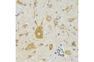 Immunohistochemistry of paraffin-embedded mouse spinal cord using NEU1 antibody (ABIN1980315) at dilution of 1:100 (40x lens). (NEU1 抗体)
