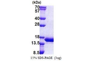 SDS-PAGE (SDS) image for Caspase Recruitment Domain Family, Member 17 (CARD17) (AA 1-110) protein (His tag) (ABIN5853219)