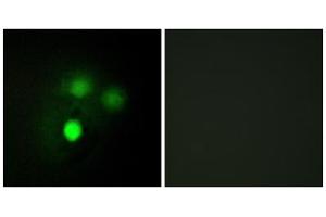Immunofluorescence analysis of HUVEC cells, using KNTC2 antibody. (NDC80 抗体  (Internal Region))