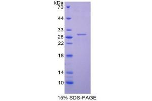 SDS-PAGE of Protein Standard from the Kit (Highly purified E. (TNNI3 CLIA Kit)