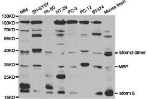 Western Blotting (WB) image for anti-Myelin Basic Protein (MBP) antibody (ABIN1873655) (MBP 抗体)
