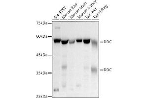 Western blot analysis of extracts of various cell lines, using DDC antibody (ABIN1679510, ABIN3018150, ABIN3018151 and ABIN6220384) at 1:500 dilution. (DDC 抗体  (AA 1-100))