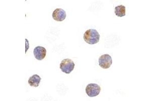 Immunocytochemistry of TIRP in Raji cells with this product at 10 μg/ml. (TICAM2 抗体  (C-Term))