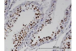 Immunoperoxidase of monoclonal antibody to RNF25 on formalin-fixed paraffin-embedded human testis. (RNF25 抗体  (AA 352-459))