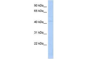 WB Suggested Anti-TSPYL6 Antibody Titration: 0. (TSPY-Like 6 抗体  (N-Term))