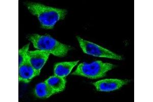 Confocal immunofluorescent analysis of LDHA antibody with A375 cells followed by Alexa Fluor 488-conjugated goat anti-rabbit lgG (green). (Lactate Dehydrogenase A 抗体  (AA 204-232))