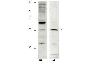 Western blot using  affinity purified anti-Hus1B antibody shows detection of a 36kDa band corresponding to Hus1B in a HeLa cell lysate (arrowhead). (HUS1B 抗体  (AA 104-117))