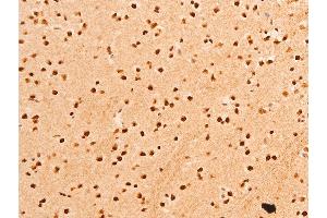 ABIN6267306 at 1/100 staining rat brain tissue sections by IHC-P. (C-JUN 抗体  (pThr91))