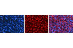Rabbit Anti-TAPBP Antibody   Formalin Fixed Paraffin Embedded Tissue: Human Liver Tissue Observed Staining: Cytoplasm in hepatocytes Primary Antibody Concentration: 1:100 Other Working Concentrations: N/A Secondary Antibody: Donkey anti-Rabbit-Cy3 Secondary Antibody Concentration: 1:200 Magnification: 20X Exposure Time: 0. (TAPBP 抗体  (N-Term))