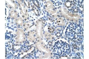 Loricrin antibody was used for immunohistochemistry at a concentration of 4-8 ug/ml to stain Epithelial cells of renal tubule (arrows) in Human Kidney. (LOR 抗体  (N-Term))