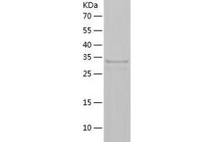 Western Blotting (WB) image for Tryptophan Hydroxylase 2 (TPH2) (AA 151-466) protein (His tag) (ABIN7287862) (Tryptophan Hydroxylase 2 Protein (TPH2) (AA 151-466) (His tag))