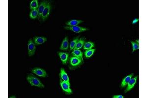 Immunofluorescence (IF) image for anti-NADH Dehydrogenase (Ubiquinone) 1 beta Subcomplex, 11, 17.3kDa (NDUFB11) (AA 30-88) antibody (ABIN7160916)