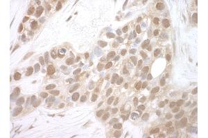 Immunohistochemistry (IHC) image for anti-BRISC and BRCA1 A Complex Member 1 (BABAM1) (AA 175-225) antibody (ABIN7448667)