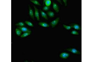 Immunofluorescent analysis of A549 cells using ABIN7163798 at dilution of 1:100 and Alexa Fluor 488-congugated AffiniPure Goat Anti-Rabbit IgG(H+L) (PCGF2 抗体  (AA 103-316))