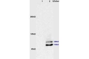 Lane 1: human colon carcinoma lysates Lane 2: mouse brain lysates probed with Anti phospho-PI3 Kinase p110 beta(Ser1070) Polyclonal Antibody, Unconjugated (ABIN872304) at 1:200 in 4 °C. (PIK3CB 抗体  (pSer1070))